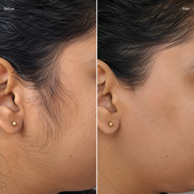 Jaw
